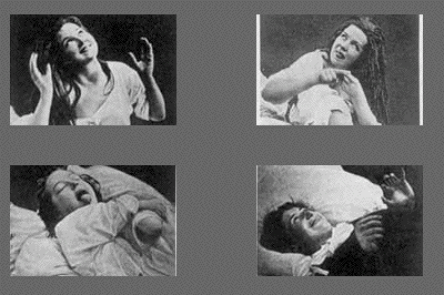 hysterie-salpetriere.gif